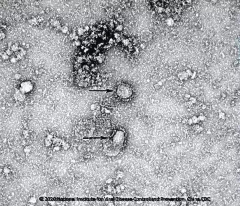 ▲新型冠狀病毒武漢株01。照片來源：國家病原微生物資源庫（中國疾病預(yù)防控制中心病毒病預(yù)防控制所）